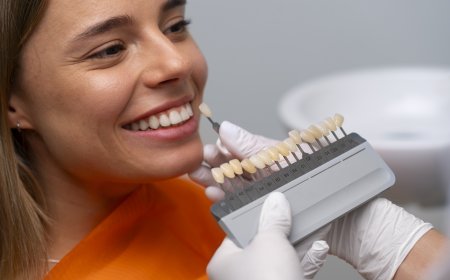 How to Find the Most Affordable Dental Crown Without Sacrificing Quality