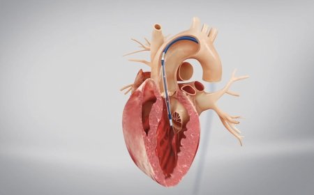 Transcatheter Heart Valve Market Size, Trends, and Strategic Outlook 2025-2032