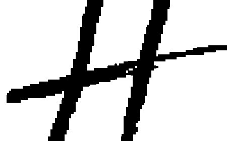 HydraFacial Treatment in Delhi Best Dermatologist in South Delhi