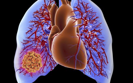 Global Chronic Thromboembolic Pulmonary Hypertension Market Growth Outlook